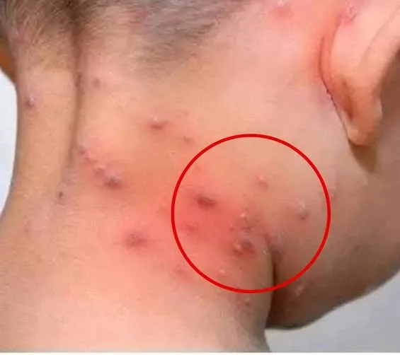 Внимание: Това са признаците, че сте з...Вижте повече 😱 3 514455259 745768121129756 6333828546044923103 n.jpg
