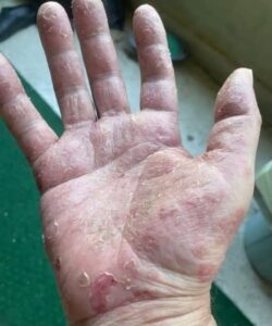 Това са знаците, че той се ра… Вижте повече 💔👇 32 608928589 122178733646593989 2947008040048859556 n