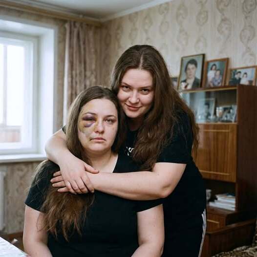 Моята сестра близначка се появи на прага ми цялата в синини. Когато разбрах, че съпругът ѝ я тормози, решихме да разменим местата си, за да му дадем урок, който никога няма да забрави… 😲😲😲 3 629837337 933260182607286 849443